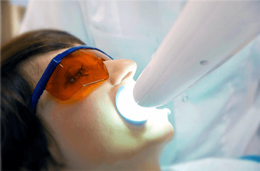 Understanding the Causes of Teeth Sensitivity Solihull