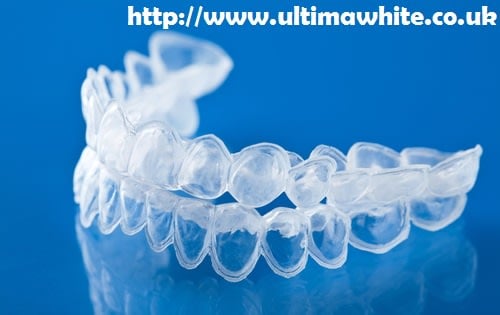 Bleaching Trays vs At-Home Laser Teeth Whitening Solihull
