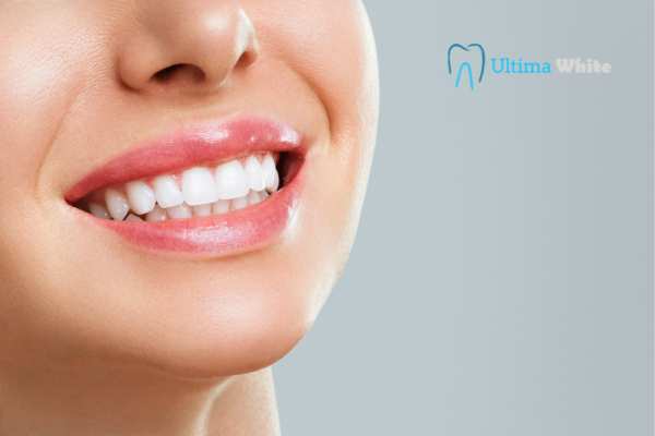 Common Mistakes That Can Ruin Your Whitening Results Solihull