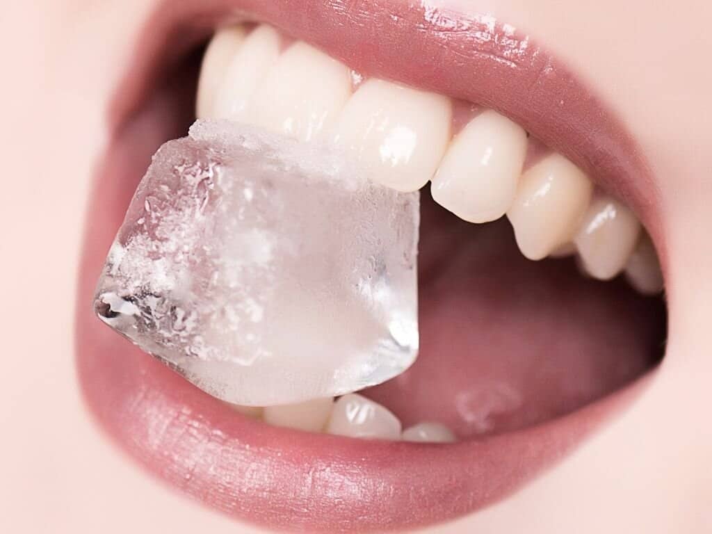 When to Combine Diet with Professional Teeth Whitening Treatments Solihull