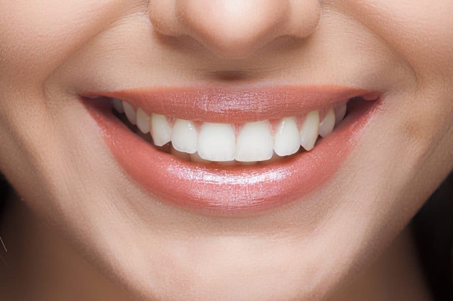 Beyond Whitening: How Your Daily Diet Affects Long-Term Smile Brightness Solihull