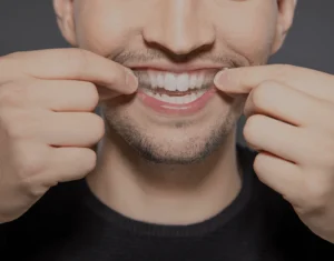 Overview of Home Teeth Whitening Kits Solihull