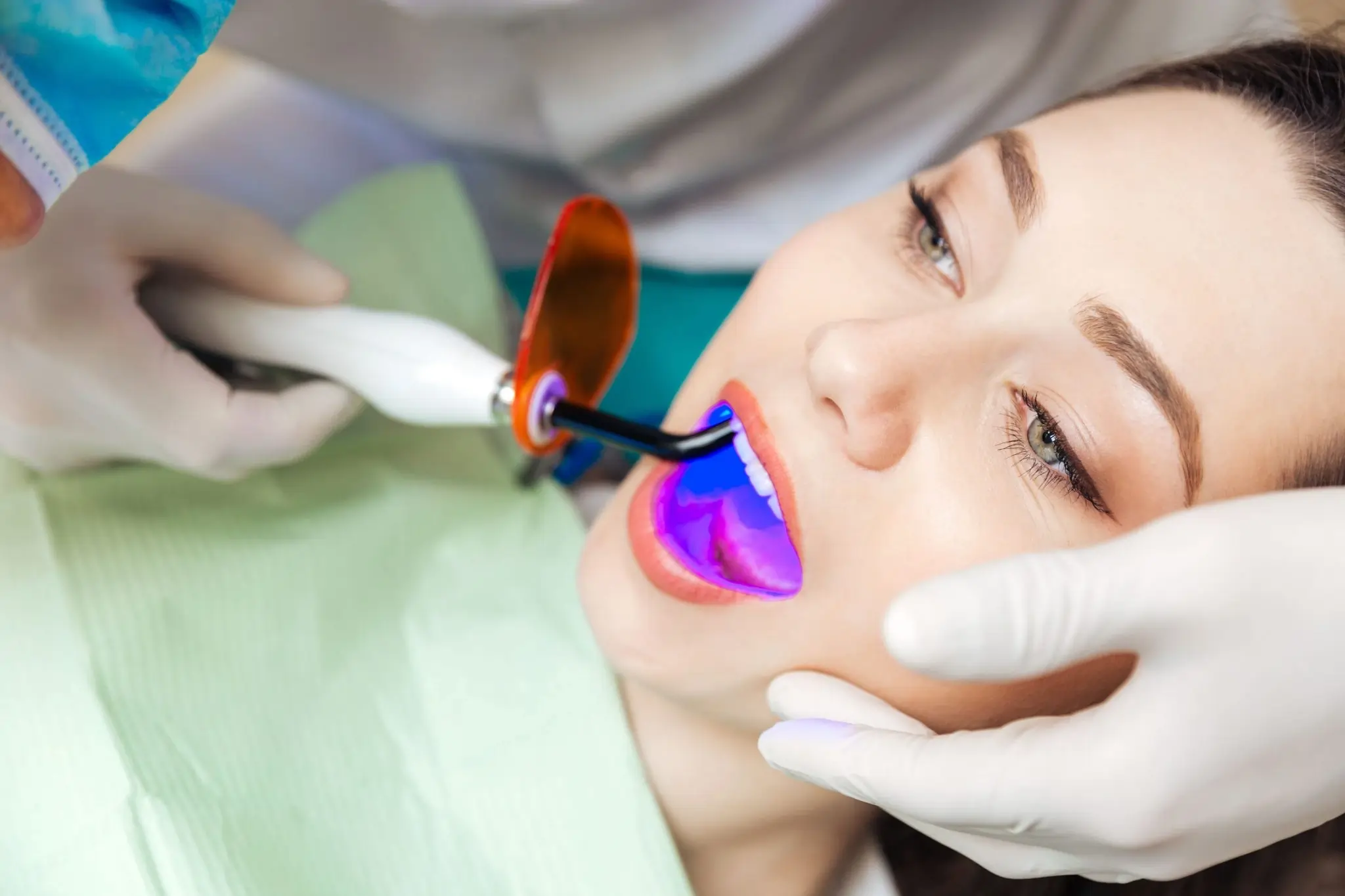 What You Need to Know Before Brightening Your Smile Solihull