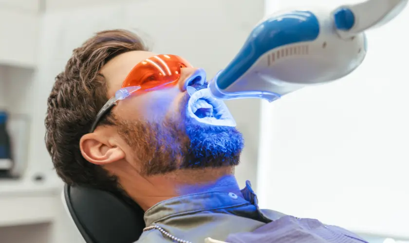 How Does Laser Teeth Whitening Actually Work Solihull?