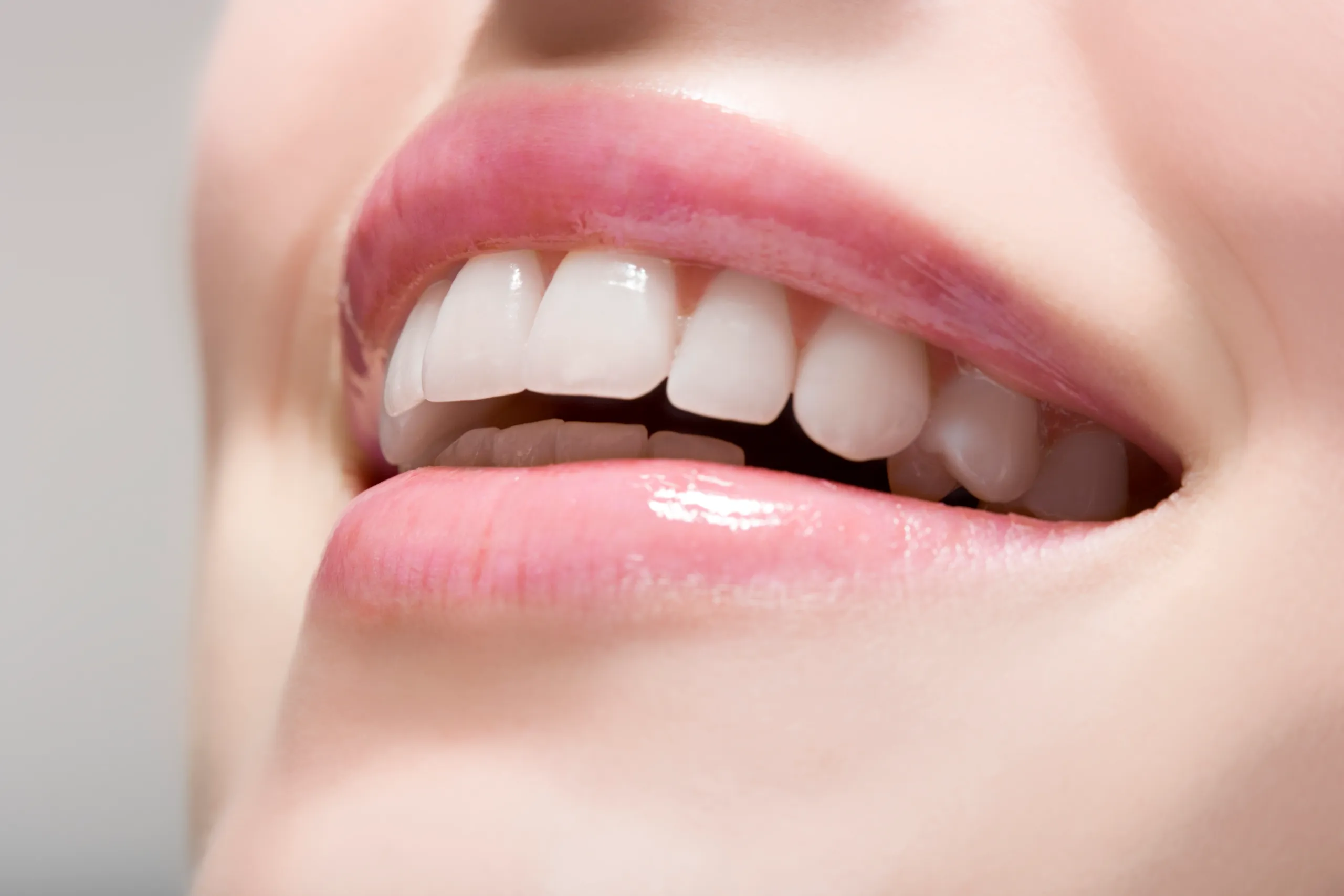 The Truth About Natural Teeth Whitening: Are Home Remedies Safe and Effective Solihull