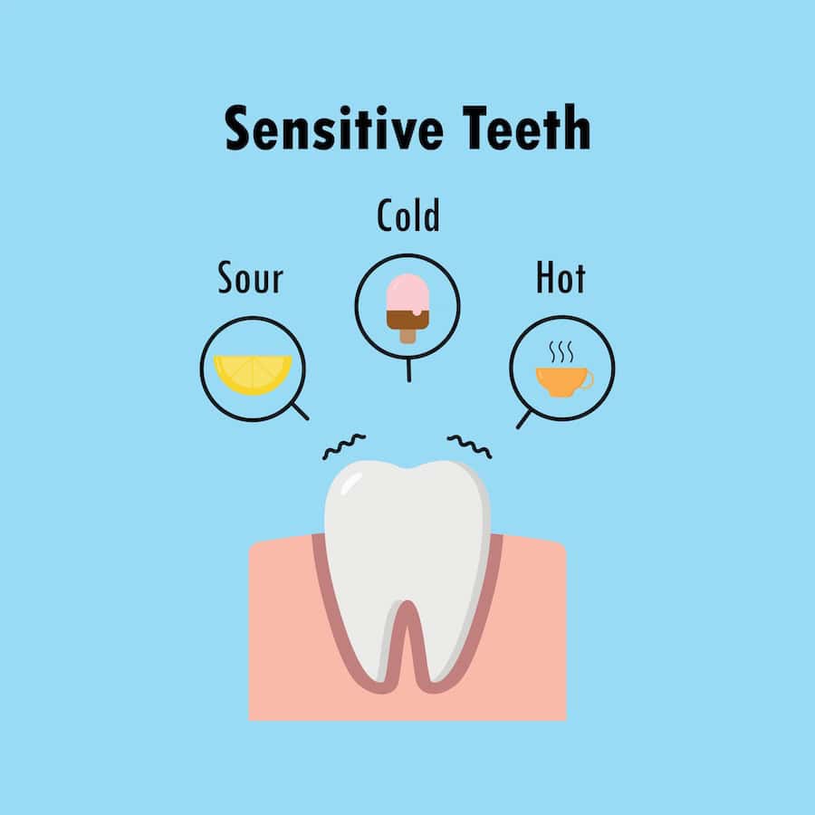 Why Do Teeth Become Sensitive After Whitening Treatments Solihull?