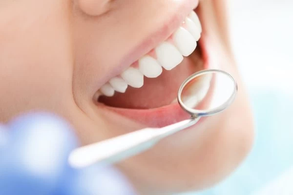 The Science Behind Natural Whitening: Myth vs Reality Solihull