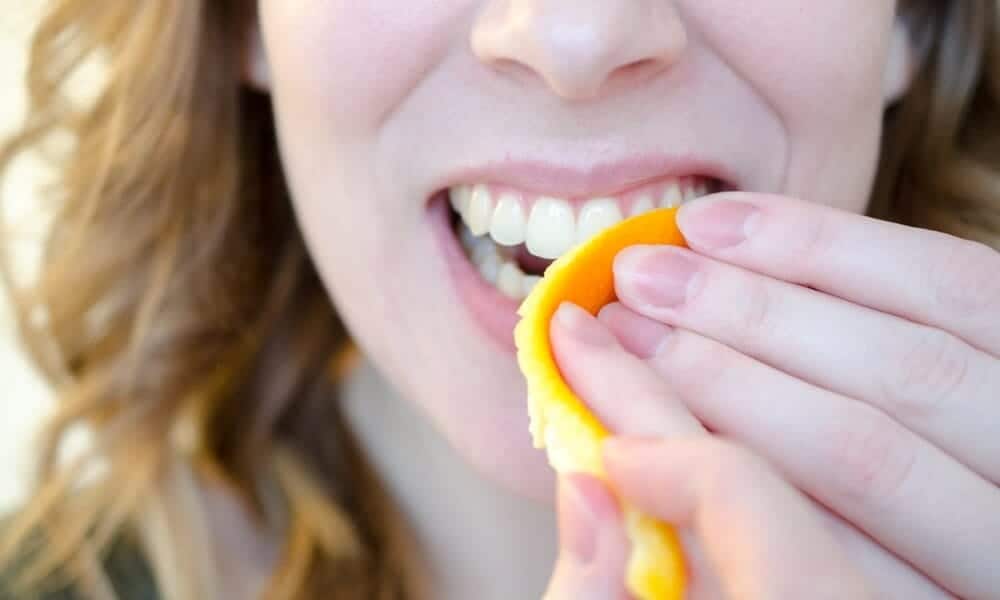 How Long Does Natural Teeth Whitening Take to Show Results Solihull?