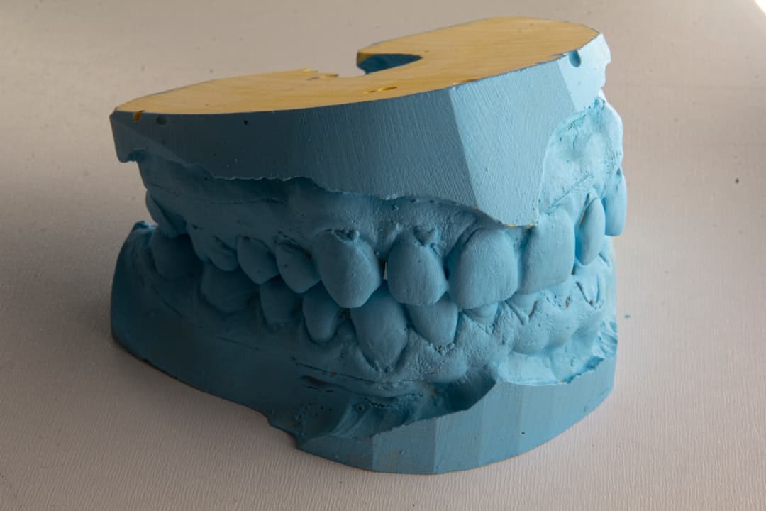 How Do Dental Implants Improve Jawbone Health and Oral Function Solihull?