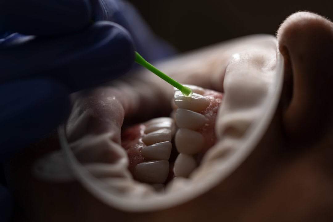 Common Causes of Persistent Dry Mouth Solihull