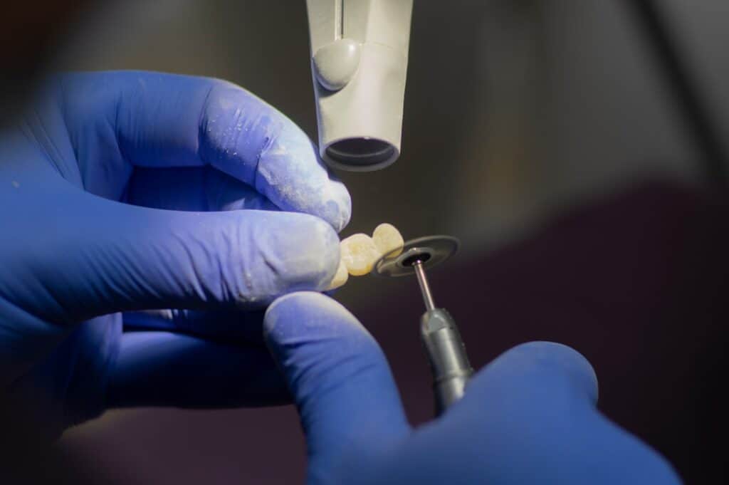 Customised Dental Solutions: Crowns, Aligners, and Implants Solihull