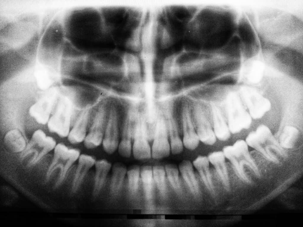 The Future of 3D Printing in Oral Healthcare Solihull